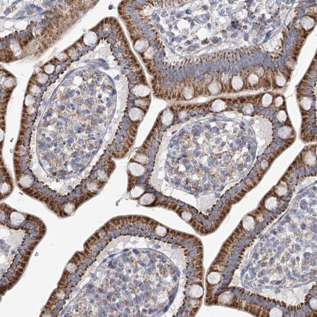 SNX7 Antibody in Immunohistochemistry (IHC)