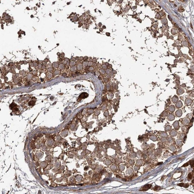 THAP9 Antibody in Immunohistochemistry (IHC)