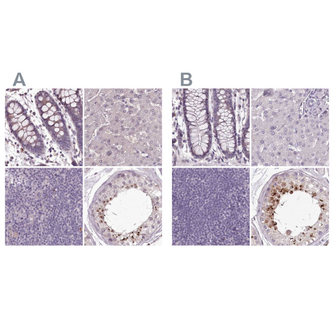 MENT Antibody in Immunohistochemistry (IHC)