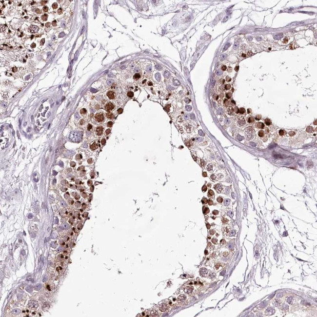 MENT Antibody in Immunohistochemistry (Paraffin) (IHC (P))