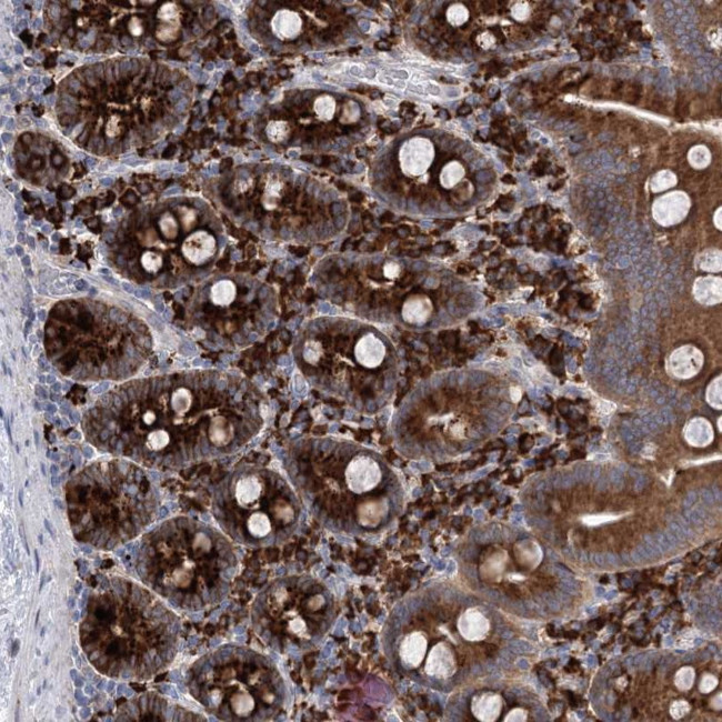 METTL24 Antibody in Immunohistochemistry (Paraffin) (IHC (P))