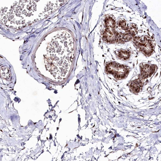 DMP1 Antibody in Immunohistochemistry (Paraffin) (IHC (P))