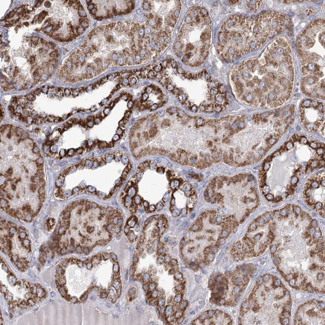RANBP3L Antibody in Immunohistochemistry (Paraffin) (IHC (P))
