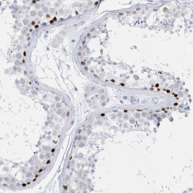 TMCO6 Antibody in Immunohistochemistry (IHC)