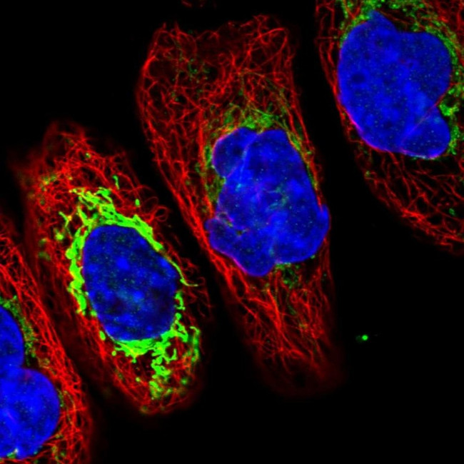 TMCO6 Antibody in Immunocytochemistry (ICC/IF)