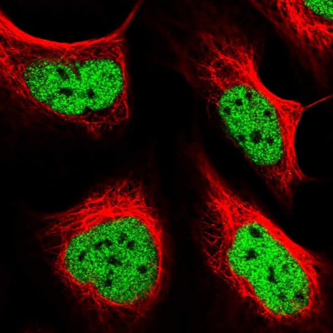 FIP1L1 Antibody in Immunocytochemistry (ICC/IF)