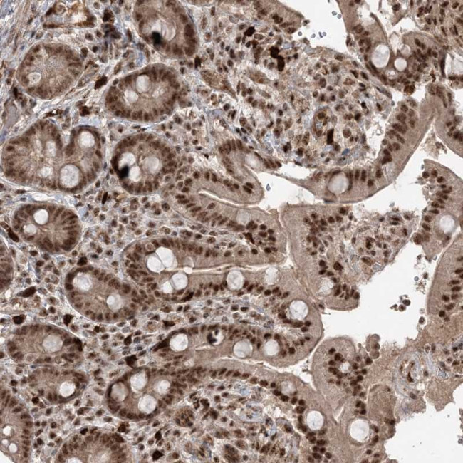 RBM17 Antibody in Immunohistochemistry (Paraffin) (IHC (P))