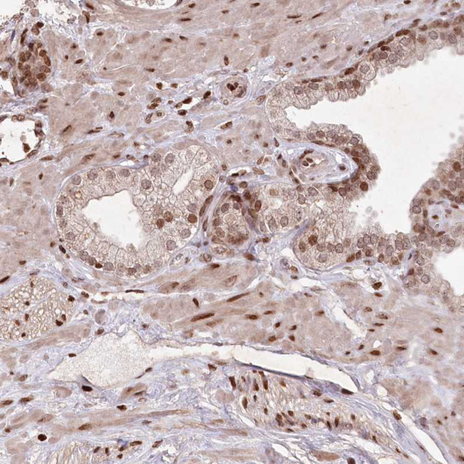 CCSER2 Antibody in Immunohistochemistry (Paraffin) (IHC (P))