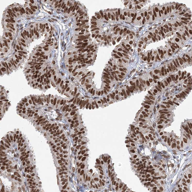 ZCCHC8 Antibody in Immunohistochemistry (Paraffin) (IHC (P))