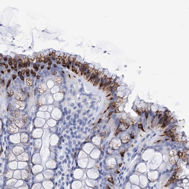 FBXW12 Antibody in Immunohistochemistry (Paraffin) (IHC (P))