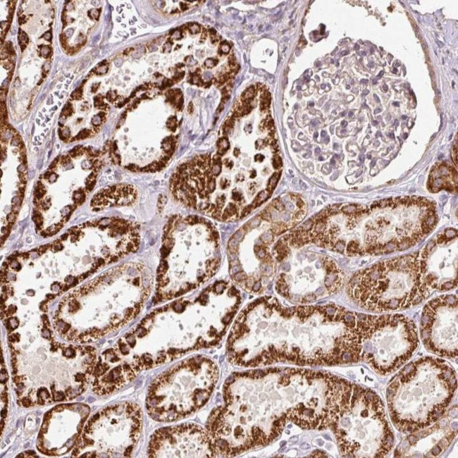 eRF1 Antibody in Immunohistochemistry (IHC)