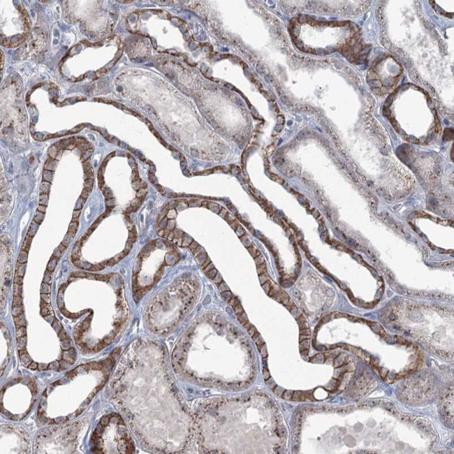 FAM120B Antibody in Immunohistochemistry (IHC)