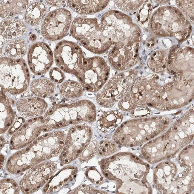 FAM120B Antibody in Immunohistochemistry (IHC)