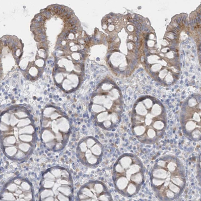 SEMA3D Antibody in Immunohistochemistry (Paraffin) (IHC (P))