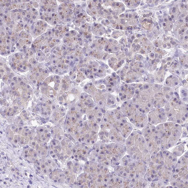ZFYVE27 Antibody in Immunohistochemistry (Paraffin) (IHC (P))