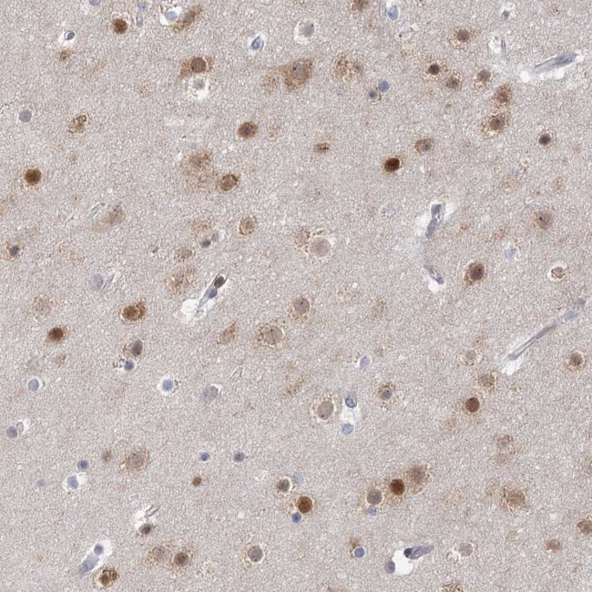 USP11 Antibody in Immunohistochemistry (Paraffin) (IHC (P))