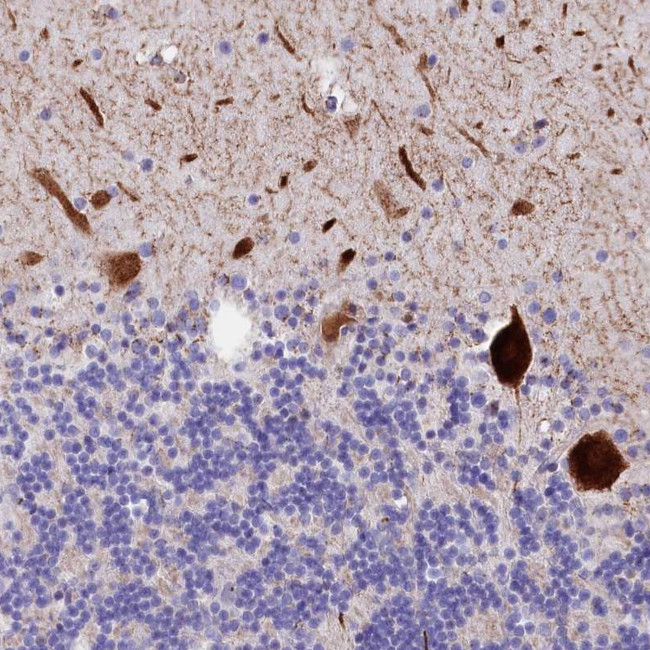 RPUSD3 Antibody in Immunohistochemistry (Paraffin) (IHC (P))