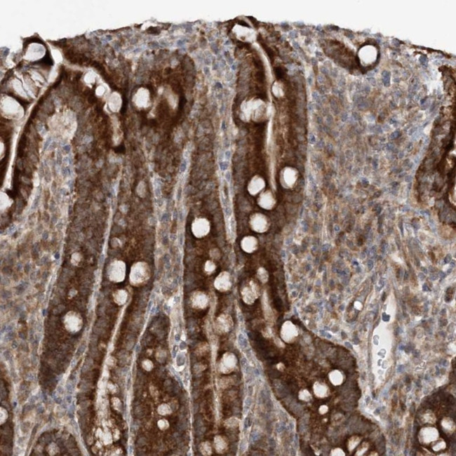 MRPL47 Antibody in Immunohistochemistry (Paraffin) (IHC (P))