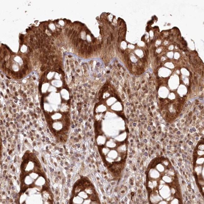 FAM179A Antibody in Immunohistochemistry (Paraffin) (IHC (P))