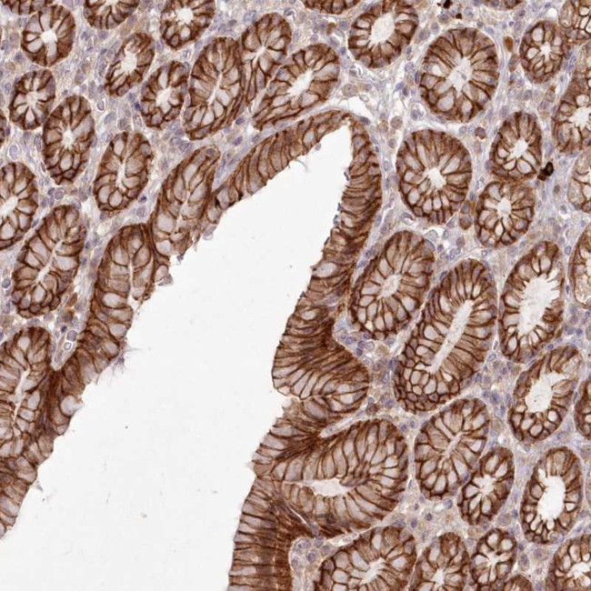 FAM179A Antibody in Immunohistochemistry (Paraffin) (IHC (P))