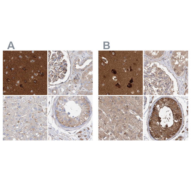 WDR37 Antibody in Immunohistochemistry (IHC)