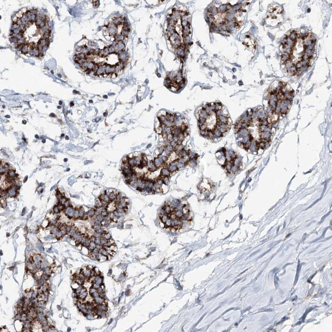 PYROXD2 Antibody in Immunohistochemistry (Paraffin) (IHC (P))