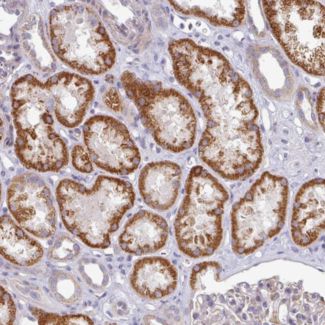 PYROXD2 Antibody in Immunohistochemistry (Paraffin) (IHC (P))