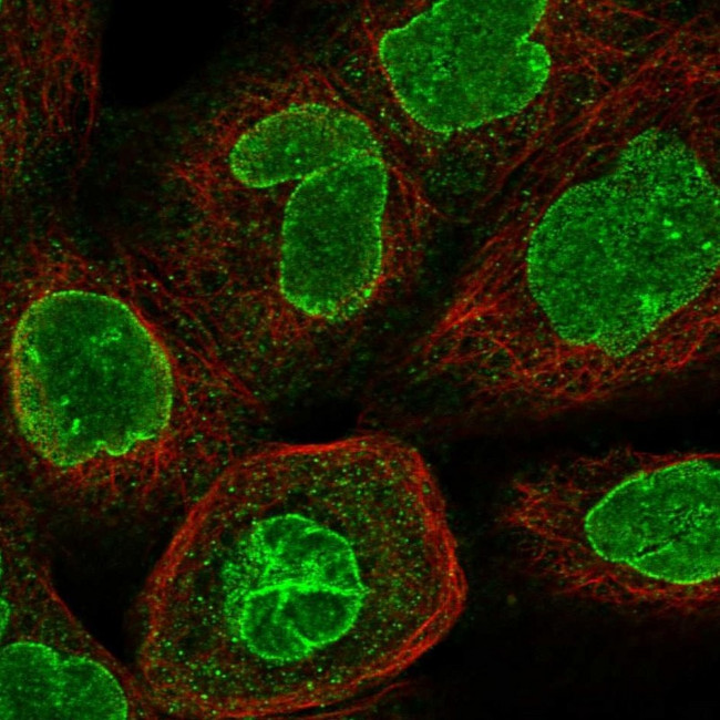 CCDC34 Antibody in Immunocytochemistry (ICC/IF)