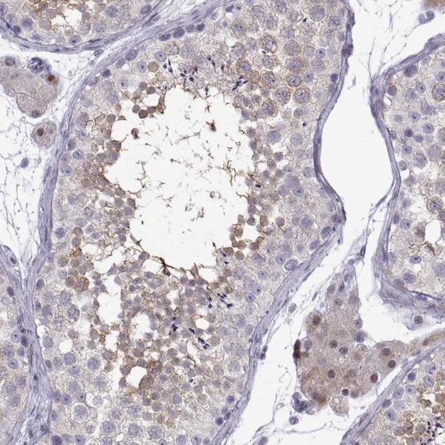 TTC18 Antibody in Immunohistochemistry (IHC)