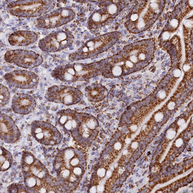 C1D Antibody in Immunohistochemistry (Paraffin) (IHC (P))