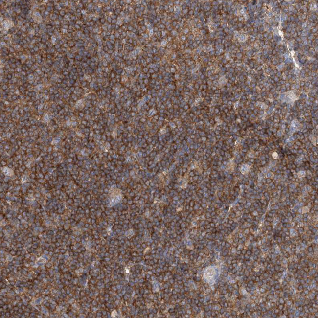 FAM175B Antibody in Immunohistochemistry (Paraffin) (IHC (P))