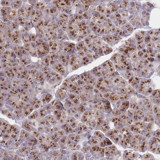FAM175B Antibody in Immunohistochemistry (Paraffin) (IHC (P))