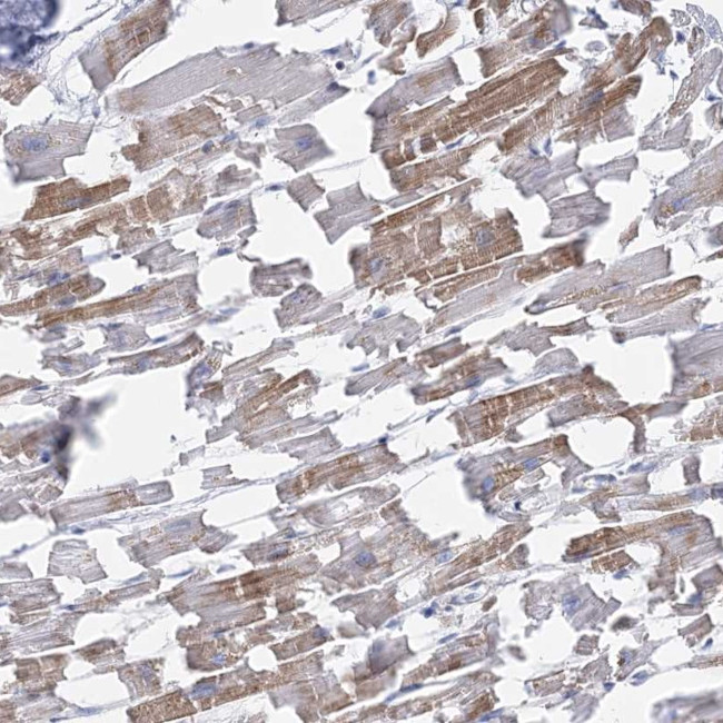 C11orf21 Antibody in Immunohistochemistry (Paraffin) (IHC (P))