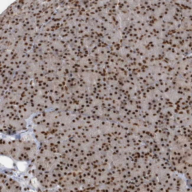 SEPHS1 Antibody in Immunohistochemistry (Paraffin) (IHC (P))