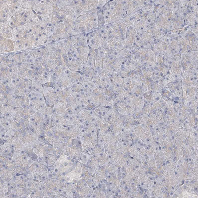 GUCY2C Antibody in Immunohistochemistry (Paraffin) (IHC (P))