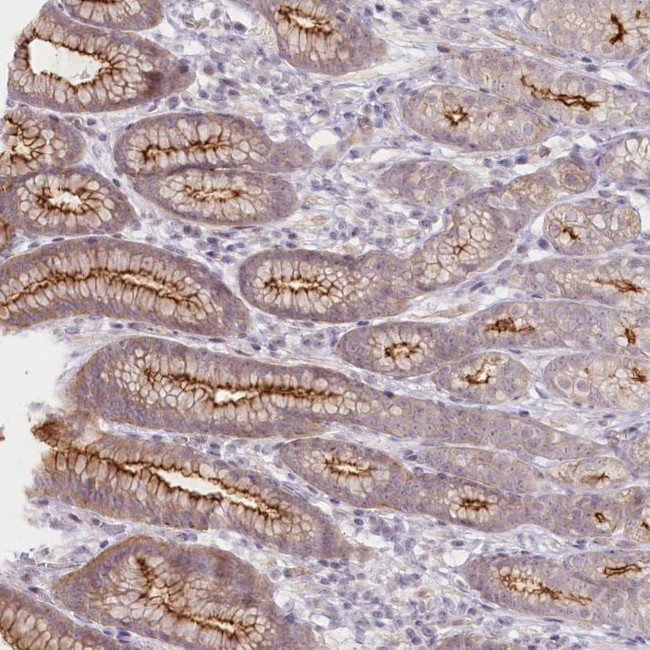 ABHD8 Antibody in Immunohistochemistry (Paraffin) (IHC (P))