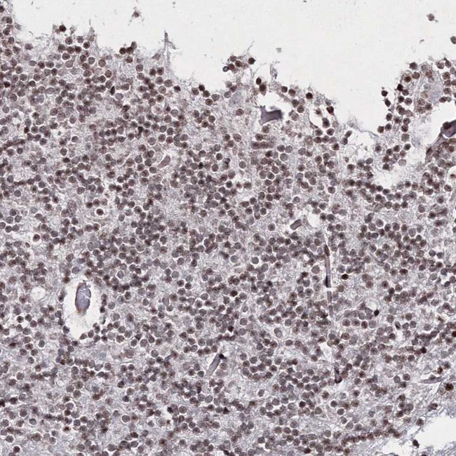 C6orf1 Antibody in Immunohistochemistry (Paraffin) (IHC (P))