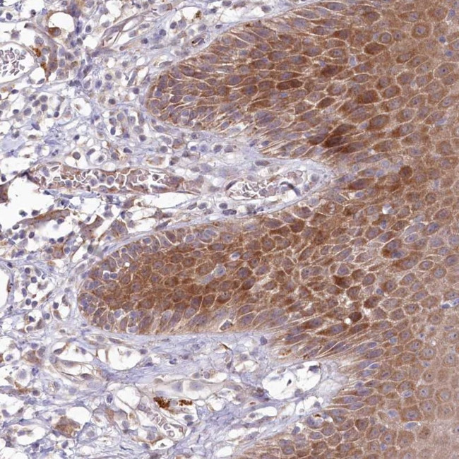 BPIL2 Antibody in Immunohistochemistry (Paraffin) (IHC (P))