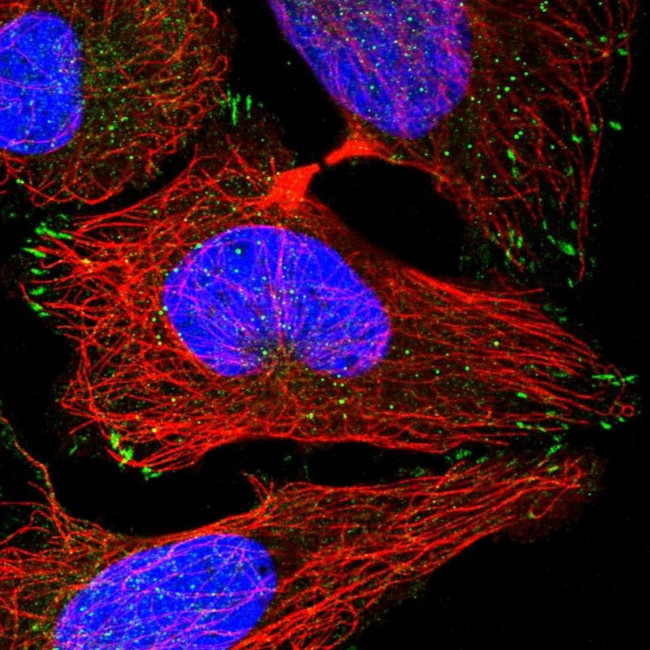LRCH4 Antibody in Immunocytochemistry (ICC/IF)