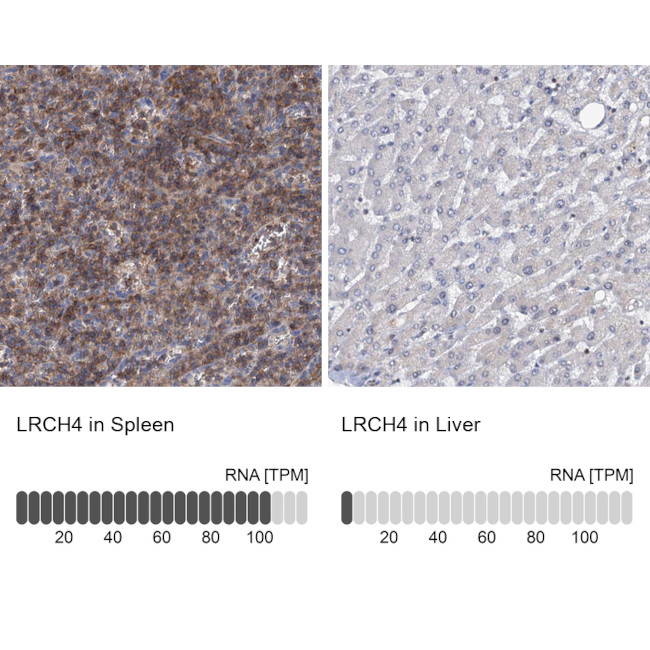 LRCH4 Antibody in Immunohistochemistry (IHC)