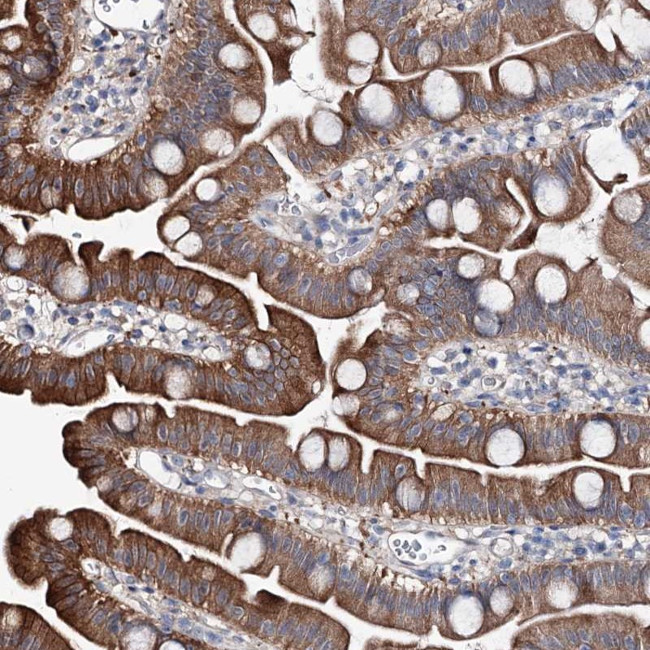 SHROOM1 Antibody in Immunohistochemistry (Paraffin) (IHC (P))