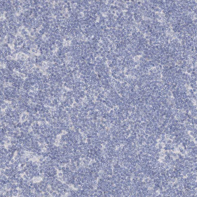 RFX6 Antibody in Immunohistochemistry (Paraffin) (IHC (P))