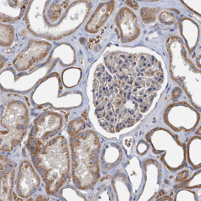 BCS1L Antibody in Immunohistochemistry (Paraffin) (IHC (P))