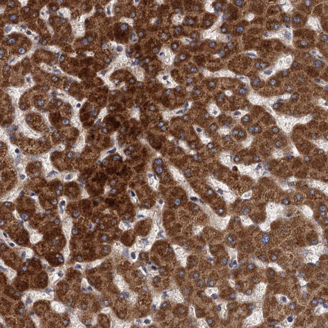 BCS1L Antibody in Immunohistochemistry (Paraffin) (IHC (P))