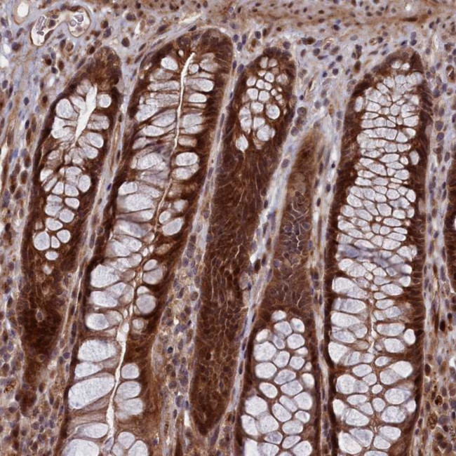 LSG1 Antibody in Immunohistochemistry (Paraffin) (IHC (P))