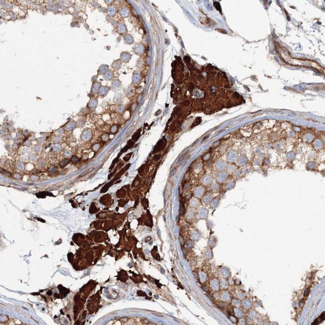 EXOC1 Antibody in Immunohistochemistry (Paraffin) (IHC (P))