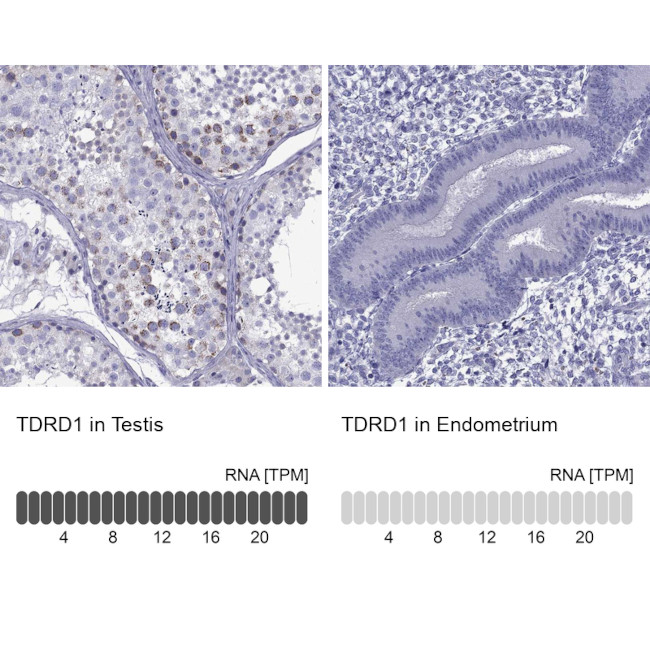 TDRD1 Antibody in Immunohistochemistry (IHC)