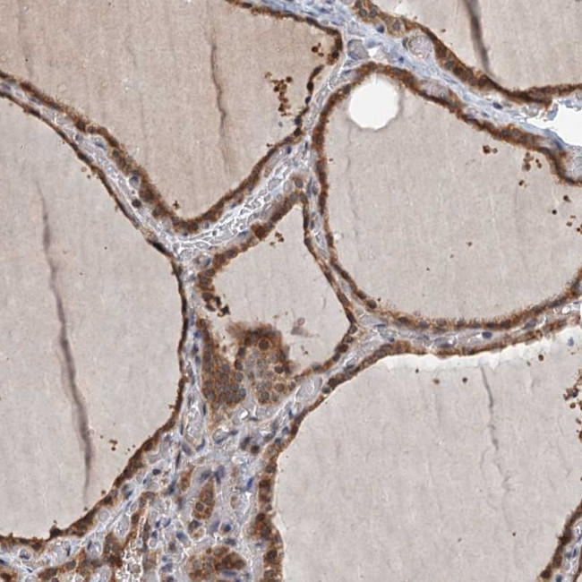 ZNF527 Antibody in Immunohistochemistry (Paraffin) (IHC (P))