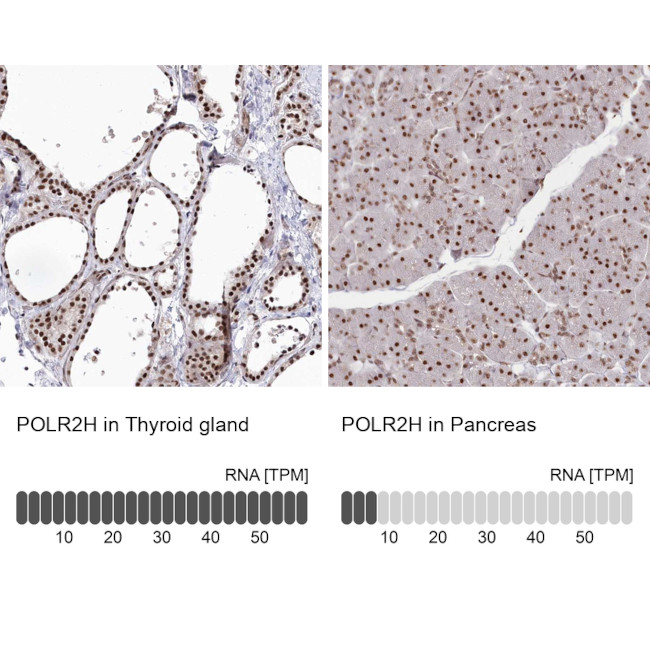 POLR2H Antibody in Immunohistochemistry (IHC)