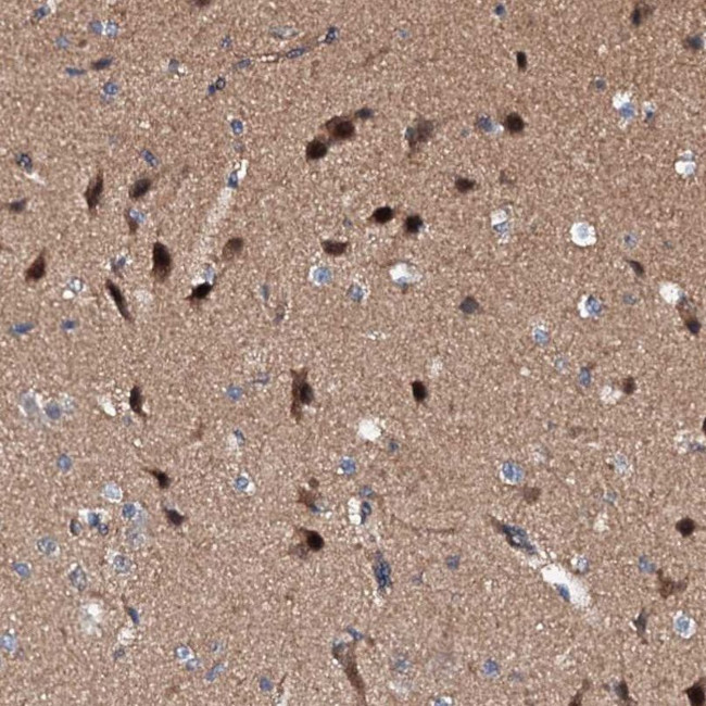 EXTL1 Antibody in Immunohistochemistry (IHC)